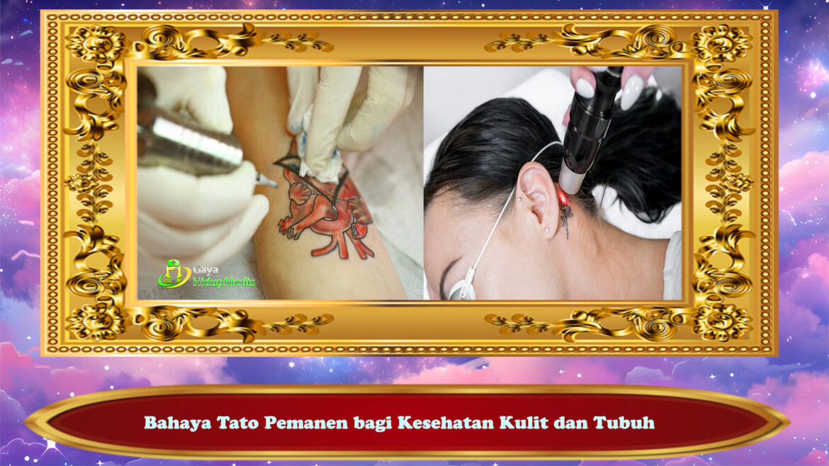 Bahaya Tato Pemanen bagi Kesehatan Kulit dan Tubuh