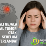 Kenali Gejala Awal Tumor Otak Sebelum Terlambat