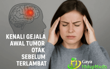 Kenali Gejala Awal Tumor Otak Sebelum Terlambat