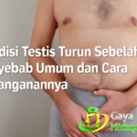 Kondisi Testis Turun Sebelah : Penyebab Umum dan Cara Penanganannya